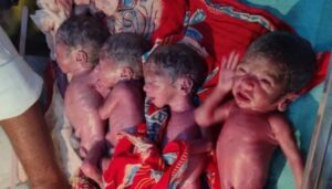 सीवान में एक महिला ने दिया एक साथ 5 बच्चों को जन्म